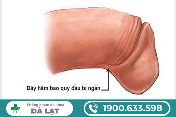 Hình ảnh minh họa